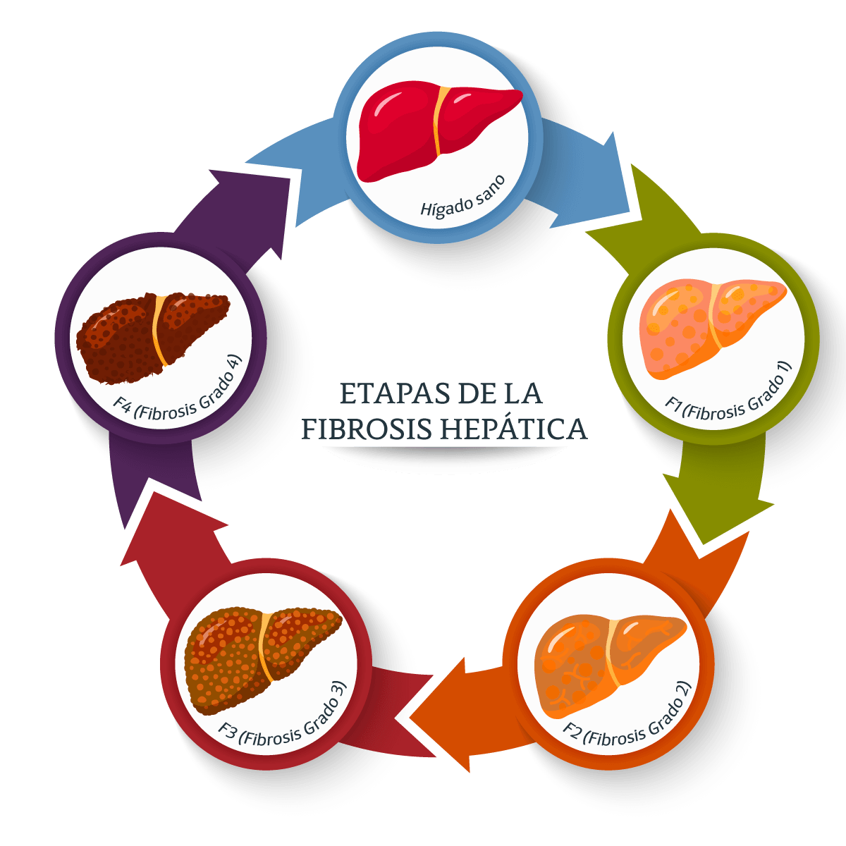 Gu�a de interpretaci�n de fibrosis hep�tica